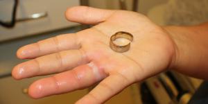 Parmağına Sıkışan Yüzüğü İtfaiye Çıkardı