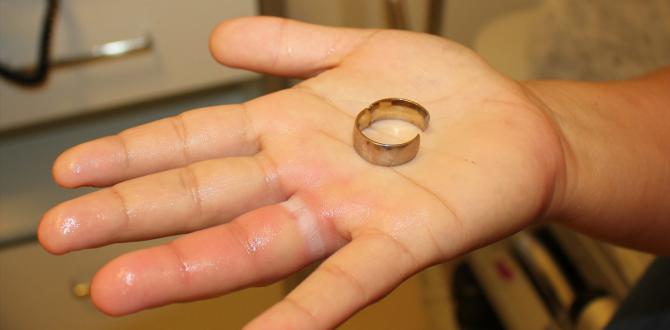 Parmağına Sıkışan Yüzüğü İtfaiye Çıkardı